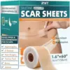 Silicone Scar Tape Roll – 60″ x 1.6″ for $3.99