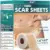 Rwt 60″ x 1.6″ Silicone Scar Tape Roll for $3.99 with Free Shipping