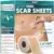 Silicone Scar Tape Roll – 60″ x 1.6″ for $3.99